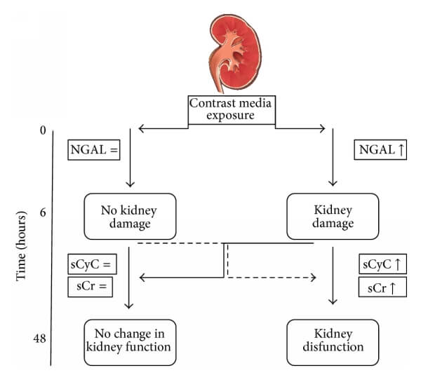 胱抑素C（CysC）與NGAL、肌酐的關(guān)系